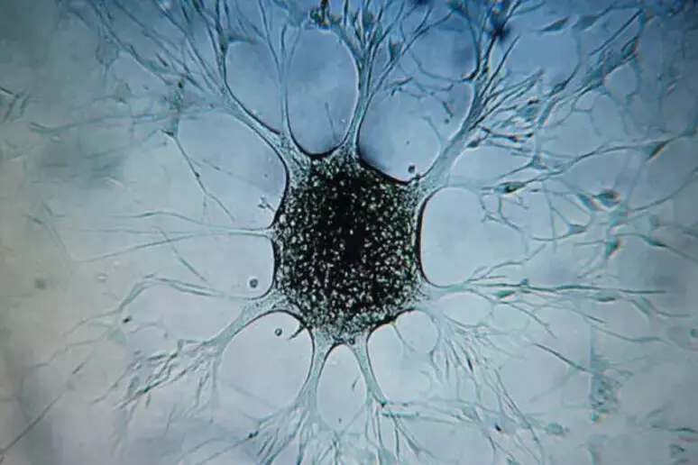 cancercerebral