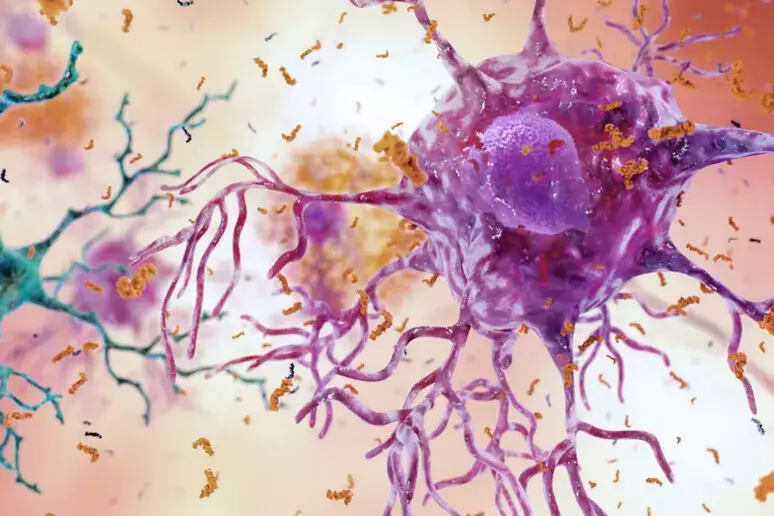 neuronasinflamadasalzheimer