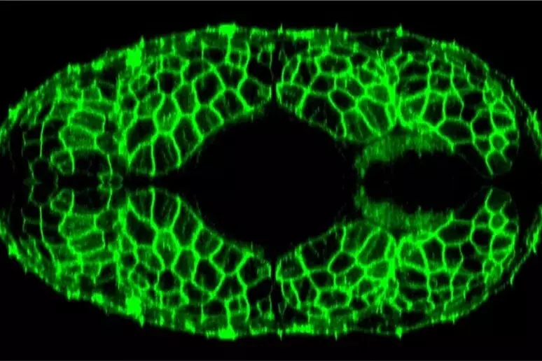 celulasmuscularestrabanocturno
