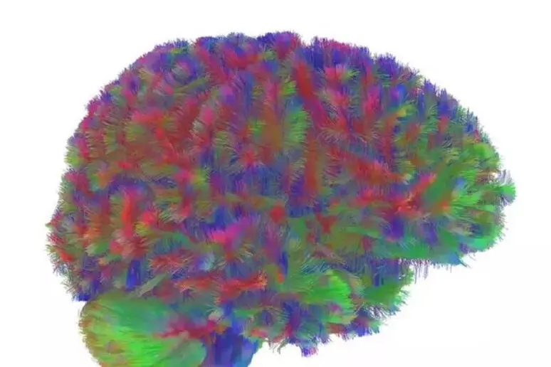 cerebrocambiosneuronales