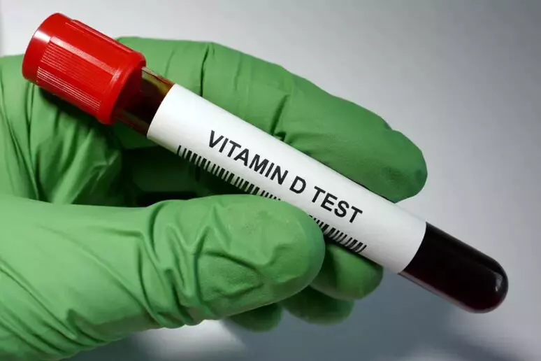 vitaminadtest