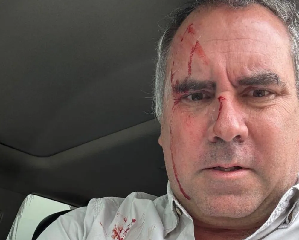 perucandidatopresidencialbaleado